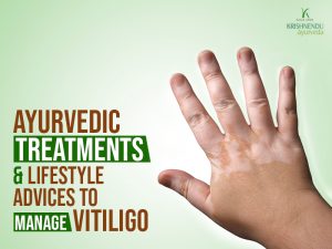 Ayurvedic treatments and lifestyle advices to manage vitiligo