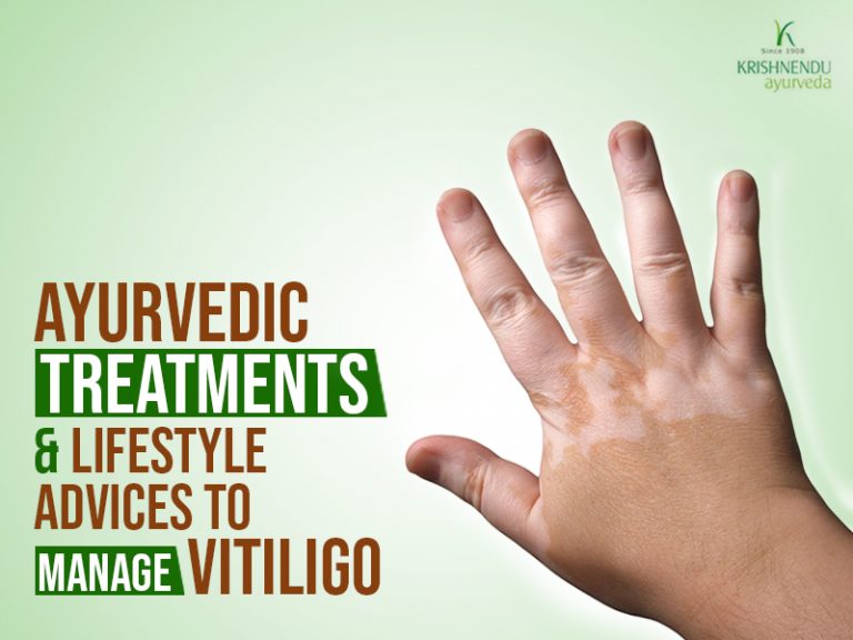 Read more about the article Ayurvedic Treatments and Lifestyle Advices to Manage Vitiligo