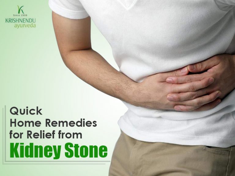 Read more about the article Quick Home Remedies for Relief from Kidney Stone