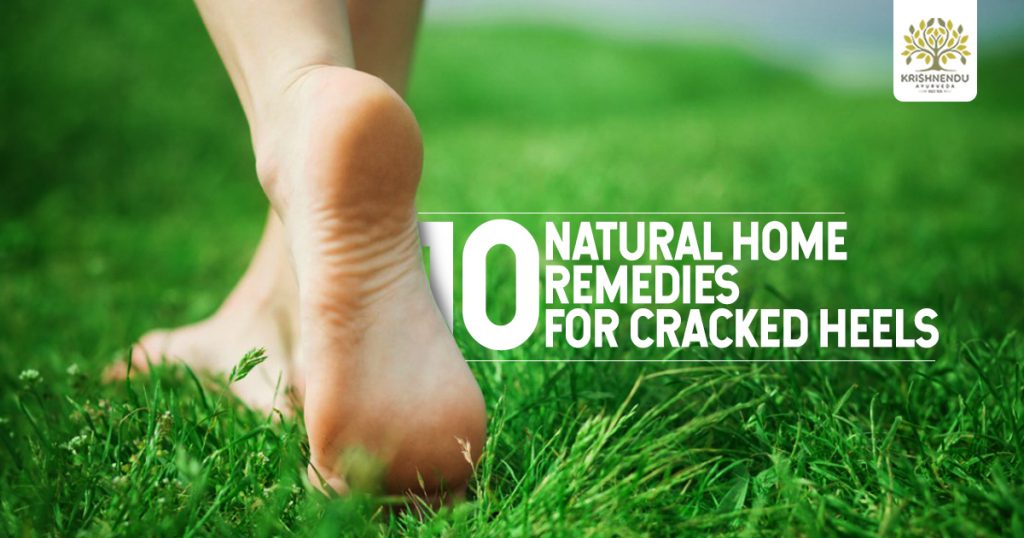 5 tips to heal cracked heels | HealthShots