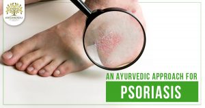 Psoriasis and Ayurvedic Treatment - Krishnendu Ayurveda